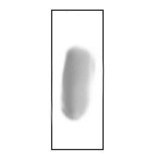 Stained PVA Smear
